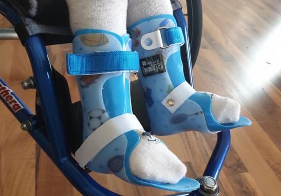 I have my first foot orthosis. They help me keep my feet in the right place.