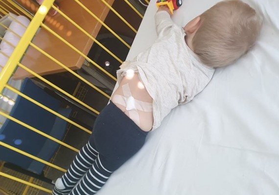 Today is 11.10.2019 and 2nd dose Spinraza is over. I did it bravely, even without tears. Hopefully the course of the following days will be better than last time, without pain ..